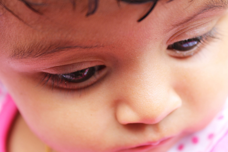 Skin Conditions In Children